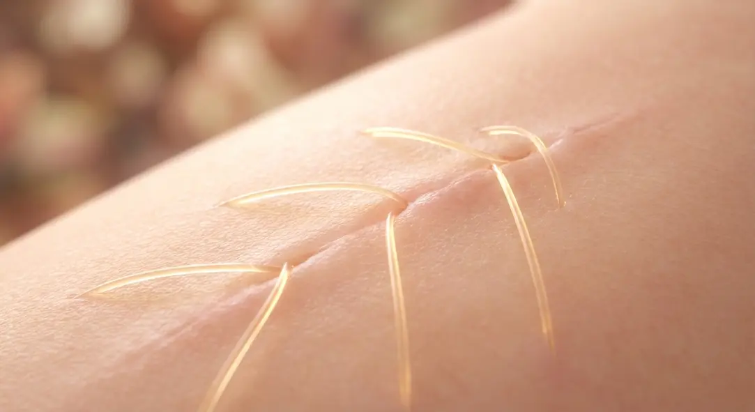 Threonine trong yến sào hỗ trợ hình thành collagen, giúp vết thương liền sẹo đẹp.